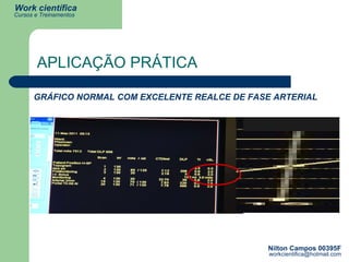 GRÁFICO NORMAL COM EXCELENTE REALCE DE FASE ARTERIAL APLICAÇÃO PRÁTICA 