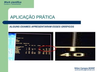 ALGUNS EXAMES APRESENTARAM ESSES GRÁFICOS APLICAÇÃO PRÁTICA 