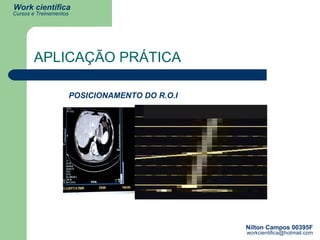 APLICAÇÃO PRÁTICA POSICIONAMENTO DO R.O.I 