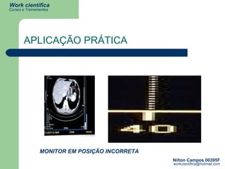 APLICAÇÃO PRÁTICA MONITOR EM POSIÇÃO INCORRETA 