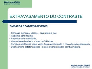 EXTRAVASAMENTO DO CONTRASTE •  Crianças menores, idosos – não referem dor. • Paciente com trauma. • Paciente com obesidade. • Veias cateterizadas por mais de 24 horas. • Punções periféricas usam veias finas aumentando o risco de extravasamento. • Usar sempre cateter plástico ( gelco) quando utilizar bomba injetora. CUIDADOS E FATORES DE RISCO 