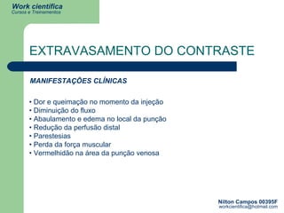 EXTRAVASAMENTO DO CONTRASTE MANIFESTAÇÕES CLÍNICAS •  Dor e queimação no momento da injeção • Diminuição do fluxo • Abaulamento e edema no local da punção  • Redução da perfusão distal • Parestesias • Perda da força muscular • Vermelhidão na área da punção venosa 