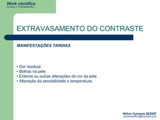 •  Dor residual • Bolhas na pele • Eritema ou outras alterações da cor da pele  • Alteração da sensibilidade e temperatura. MANIFESTAÇÕES TARDIAS EXTRAVASAMENTO DO CONTRASTE 