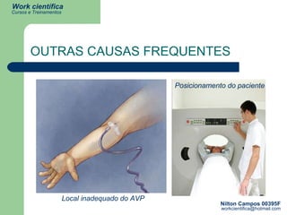 OUTRAS CAUSAS FREQUENTES Local inadequado do AVP Posicionamento do paciente 