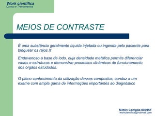 MEIOS DE CONTRASTE É uma substância geralmente líquida injetada ou ingerida pelo paciente para bloquear os raios X  Endovenoso a base de iodo, cuja densidade metálica permite diferenciar vasos e estruturas e demonstrar processos dinâmicos de funcionamento dos órgãos estudados.  O pleno conhecimento da utilização desses compostos, conduz a um exame com ampla gama de informações importantes ao diagnóstico 