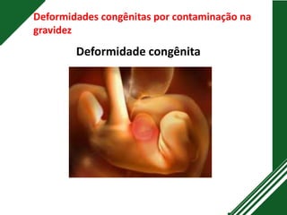 Deformidades congênitas por contaminação na
gravidez
Deformidade congênita
 