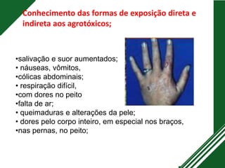 •salivação e suor aumentados;
• náuseas, vômitos,
•cólicas abdominais;
• respiração difícil,
•com dores no peito
•falta de ar;
• queimaduras e alterações da pele;
• dores pelo corpo inteiro, em especial nos braços,
•nas pernas, no peito;
Conhecimento das formas de exposição direta e
indireta aos agrotóxicos;
 