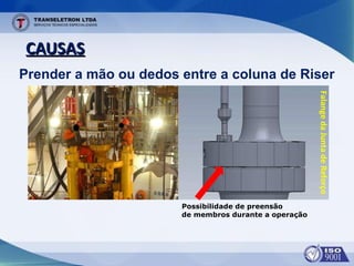 CAUSASCAUSAS
Prender a mão ou dedos entre a coluna de Riser
FalangedaJuntadeReforço
Possibilidade de preensão
de membros durante a operação
 