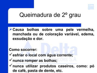 Causa bolhas sobre uma pele vermelha,
manchada ou de coloração variável, edema,
exsudação e dor.
Como socorrer:
esfriar o local com água corrente;
nunca romper as bolhas;
nunca utilizar produtos caseiros, como: pó
de café, pasta de dente, etc.
Queimadura de 2º grau
 