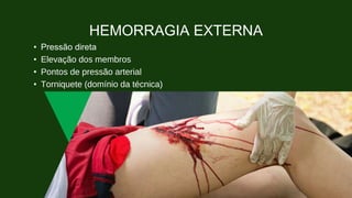 HEMORRAGIA EXTERNA
• Pressão direta
• Elevação dos membros
• Pontos de pressão arterial
• Torniquete (domínio da técnica)
 