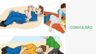 CONVULSÃO
 