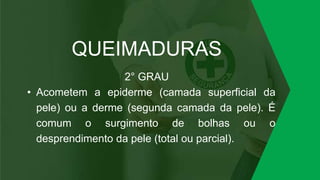 QUEIMADURAS
2° GRAU
• Acometem a epiderme (camada superficial da
pele) ou a derme (segunda camada da pele). É
comum o surgimento de bolhas ou o
desprendimento da pele (total ou parcial).
 