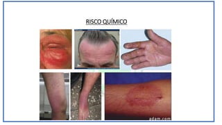 RISCO QUÍMICO
 