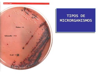 TIPOS DE
MICRORGANISMOS
 