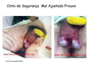 Cinto de Segurança Mal Ajustado Frouxo
Fonte: Prevenção Online
 