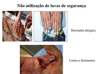 Não utilização de luvas de segurança
Dermatite alérgica
Cortes e ferimentos
 