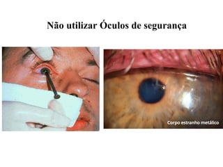 Não utilizar Óculos de segurança
 