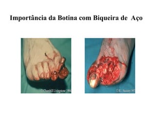 Importância da Botina com Biqueira de Aço
 