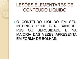 LESÕES ELEMENTARES DE
CONTEÚDO LÍQUIDO
 O CONTEÚDO LÍQUIDO EM SEU
INTERIOR PODE SER: SANGUE,
PUS OU SEROSIDADE E NA
MAIORIA DAS VEZES APRESENTA
EM FORMA DE BOLHAS.
 