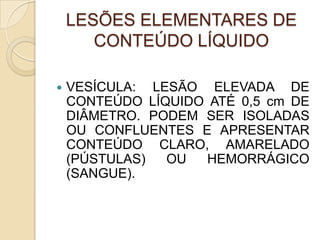 LESÕES ELEMENTARES DE
CONTEÚDO LÍQUIDO
 VESÍCULA: LESÃO ELEVADA DE
CONTEÚDO LÍQUIDO ATÉ 0,5 cm DE
DIÂMETRO. PODEM SER ISOLADAS
OU CONFLUENTES E APRESENTAR
CONTEÚDO CLARO, AMARELADO
(PÚSTULAS) OU HEMORRÁGICO
(SANGUE).
 