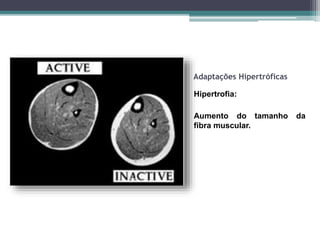 Adaptações Hipertróficas
Hipertrofia:
Aumento do tamanho da
fibra muscular.
 