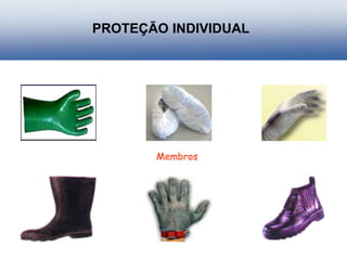 PROTEÇÃO INDIVIDUAL
Membros
 
