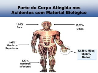 1,98%
Membros
Superiores
3,47%
Membros
Inferiores
1,98%
Face
13,37%
Olhos
12,38% Mãos
66,83%
Dedos
Parte do Corpo Atingida nos
Acidentes com Material Biológico
 