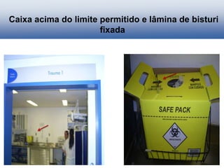 Caixa acima do limite permitido e lâmina de bisturi
fixada
 