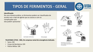 Identificação
De uma maneira prática, os ferimentos podem ser classificados de
acordo com o tipo de agente que as causou e com as
complicações que
elas podem apresentar
TELEFONES ÚTEIS: OBS, Em empresa ramal de emergência Indicado.
• Samu 192
• Corpo de Bombeiros 193
• Polícia Militar 190
 