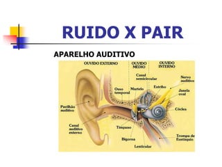 RUIDO X PAIR
APARELHO AUDITIVO
 