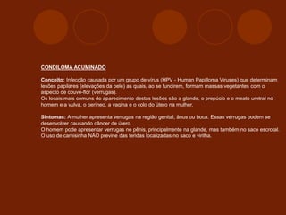 CONDILOMA ACUMINADO
Conceito: Infecção causada por um grupo de vírus (HPV - Human Papilloma Viruses) que determinam
lesões papilares (elevações da pele) as quais, ao se fundirem, formam massas vegetantes com o
aspecto de couve-flor (verrugas).
Os locais mais comuns do aparecimento destas lesões são a glande, o prepúcio e o meato uretral no
homem e a vulva, o períneo, a vagina e o colo do útero na mulher.
Sintomas: A mulher apresenta verrugas na região genital, ânus ou boca. Essas verrugas podem se
desenvolver causando câncer de útero.
O homem pode apresentar verrugas no pênis, principalmente na glande, mas também no saco escrotal.
O uso de camisinha NÃO previne das feridas localizadas no saco e virilha.
 