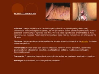 MOLUSCO CONTAGIOSO
Conceito: Doença da pele que se caracteriza pela produção de pápulas (elevações da pele)
umbelicadas (com uma depressão central), de cor que varia do branco peroláceo (translúcido) ao rosa.
Localizam-se em qualquer região da pele (face, tronco e áreas expostas das extremidades) e, mais
raramente, nas mucosas. Podem ocorrer em qualquer idade mas são mais comuns em crianças de 0 a
12 anos.
Sintomas: Surgem então pequenas pápulas que se desenvolvem numa espécie de verrugas (tumores)
claras com pedículo
Transmissão: Contato direto com pessoas infectadas. Também através de toalhas, vestimentas,
piscinas etc. Em adolescentes e adultos a localização das lesões na região anogenital sugere
transmissão sexual.
Tratamento: O tratamento de escolha é a remoção das lesões por curetagem (realizada por médico).
Prevenção: Evitar contato físico com pessoas infectadas.
 