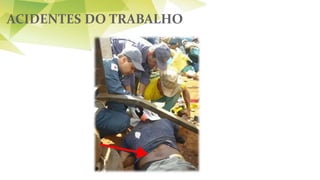 ACIDENTES DO TRABALHO
 