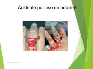 Acidente por uso de adorno!
BIOSEG CONSULTORIA
 