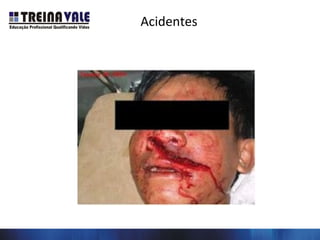 Acidentes
 