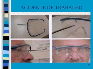20
ACIDENTE DE TRABALHO
 
