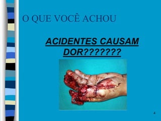 O QUE VOCÊ ACHOU
 ACIDENTES CAUSAM
DOR???????
4
 