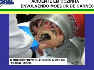 Objetivo Segurança 2016 7
ACIDENTE EM COZINHA
ENVOLVENDO MOEDOR DE CARNES
ATENÇÃO:
ESTE ACIDENTE ACONTECEU RECENTEMENTE EM UMA COZINHA INDUSTRIAL
FORA DO PAÍS MAS ELE SERVE DE EXPEMPLO PARA AQUELES QUE NÃO
ACREDITAM QUE INTRODUZIR A MÃO EM MOEDOR DE CARNES
POSSA COMPROMETER SERIAMENTE SUA SAÚDE.
ATENÇÃO : AS CENAS A SEGUIR SÃO MUITO FORTES
PORTANTO, SE VOCÊ NÃO ESTA DISPOSTO A VÊ-LAS
NÃO ABRA OS SLIDES A SEGUIR.
SAIR
SAIR
 