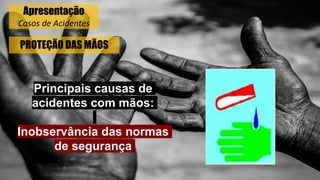 PROTEÇÃO DAS MÃOS
Principais causas de
acidentes com mãos:
Inobservância das normas
de segurança
Apresentação
Casos de Acidentes
 