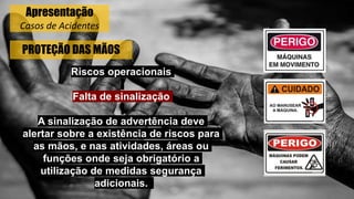 PROTEÇÃO DAS MÃOS
Riscos operacionais
Falta de sinalização
A sinalização de advertência deve
alertar sobre a existência de riscos para
as mãos, e nas atividades, áreas ou
funções onde seja obrigatório a
utilização de medidas segurança
adicionais.
Apresentação
Casos de Acidentes
 
