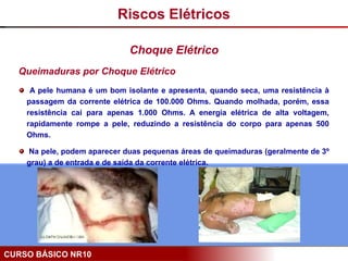 CURSO BÁSICO NR10
Queimaduras por Choque Elétrico
A pele humana é um bom isolante e apresenta, quando seca, uma resistência à
passagem da corrente elétrica de 100.000 Ohms. Quando molhada, porém, essa
resistência cai para apenas 1.000 Ohms. A energia elétrica de alta voltagem,
rapidamente rompe a pele, reduzindo a resistência do corpo para apenas 500
Ohms.
Na pele, podem aparecer duas pequenas áreas de queimaduras (geralmente de 3º
grau) a de entrada e de saída da corrente elétrica.
Riscos Elétricos
Choque Elétrico
 