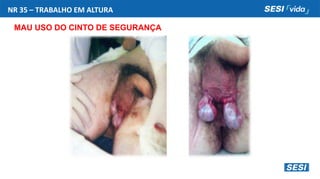 NR 35 – TRABALHO EM ALTURA
MAU USO DO CINTO DE SEGURANÇA
 