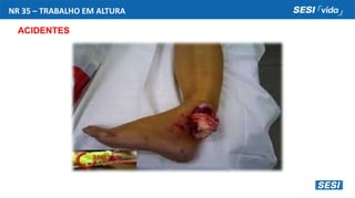 NR 35 – TRABALHO EM ALTURA
ACIDENTES
 