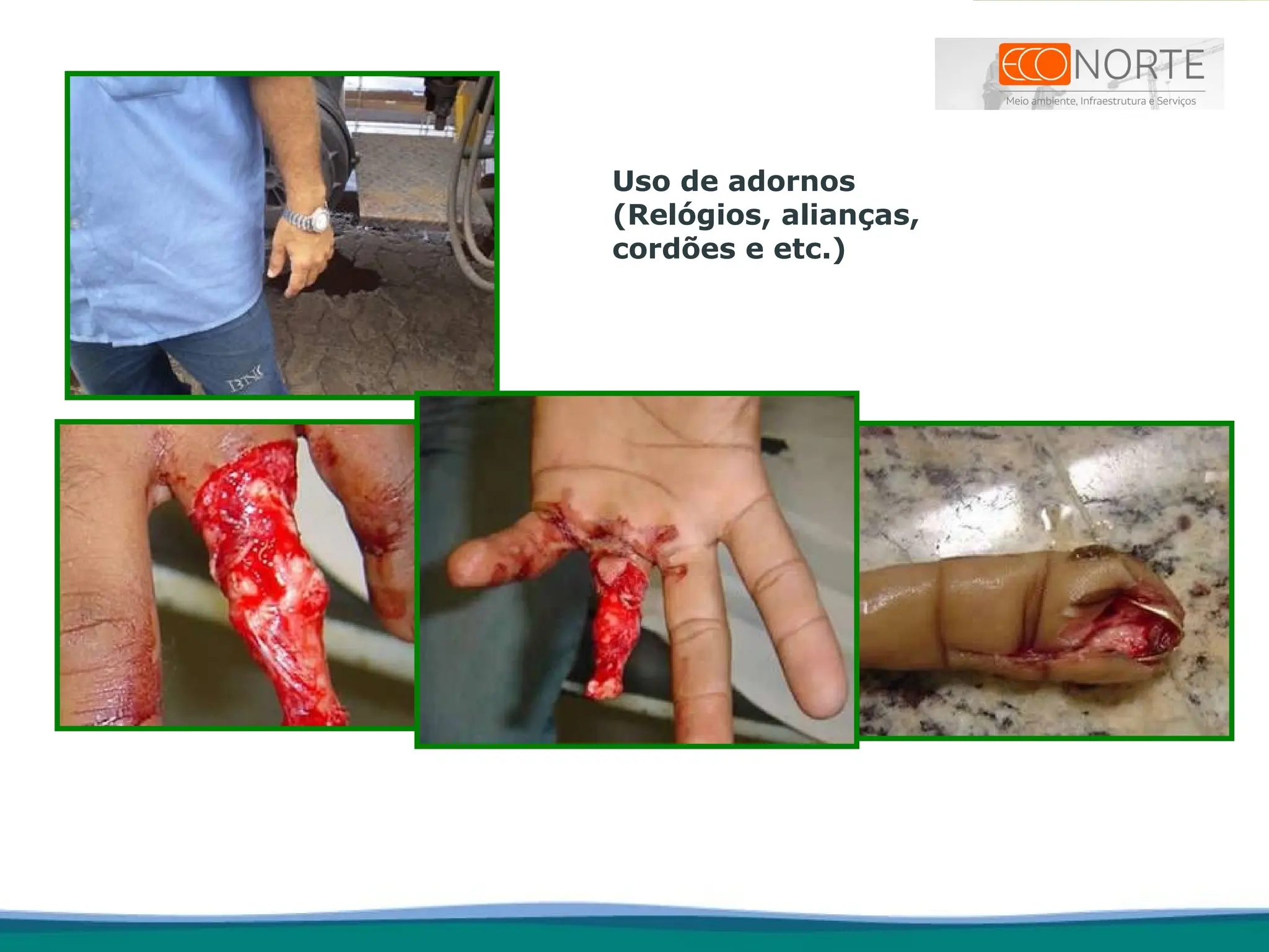 Uso de adornos
(Relógios, alianças,
cordões e etc.)
 