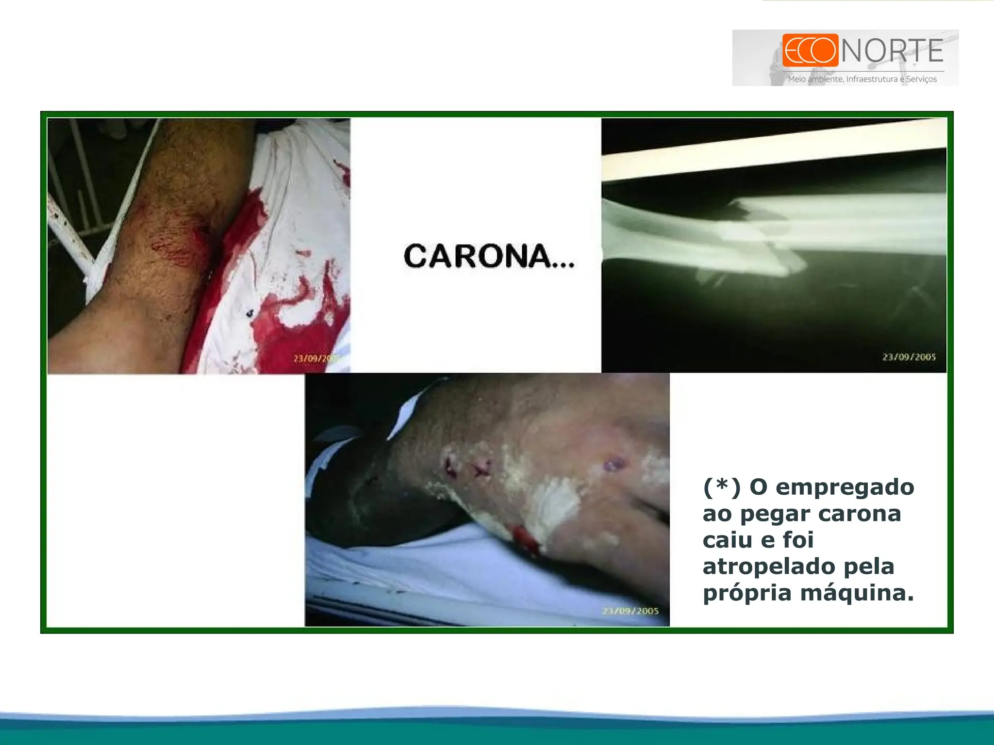 (*) O empregado
ao pegar carona
caiu e foi
atropelado pela
própria máquina.
 