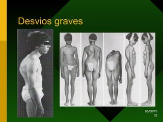 Desvios graves 