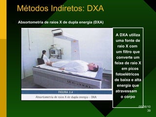 Métodos Indiretos: DXA Absortometria de raios X de dupla energia (DXA) A DXA utiliza uma fonte de raio X com  um filtro que converte um feixe de raio X  em picos fotoelétricos  de baixa e alta energia que atravessam  o corpo 
