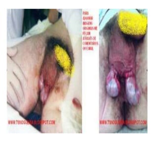 TREINAMENTO TRABALHO EM ALTURA.pptx