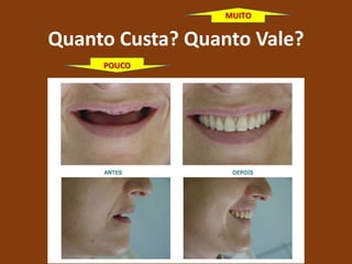 Quanto Custa? Quanto Vale?
POUCO
MUITO
 