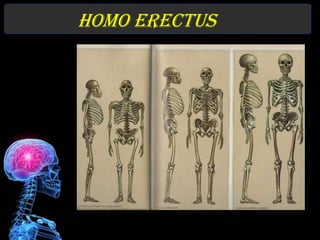 Homo erectus
 